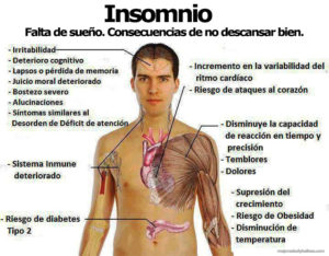 insomnio - Madrid Acupuntura