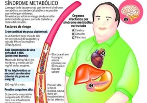 Acupuntura para el síndrome metabólico