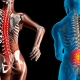Médula espinal